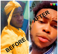 Lips Lightening Cream For Men and Women (Results in 5 Days or Less)