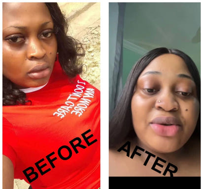 Lips Lightening Cream For Men and Women (Results in 5 Days or Less)