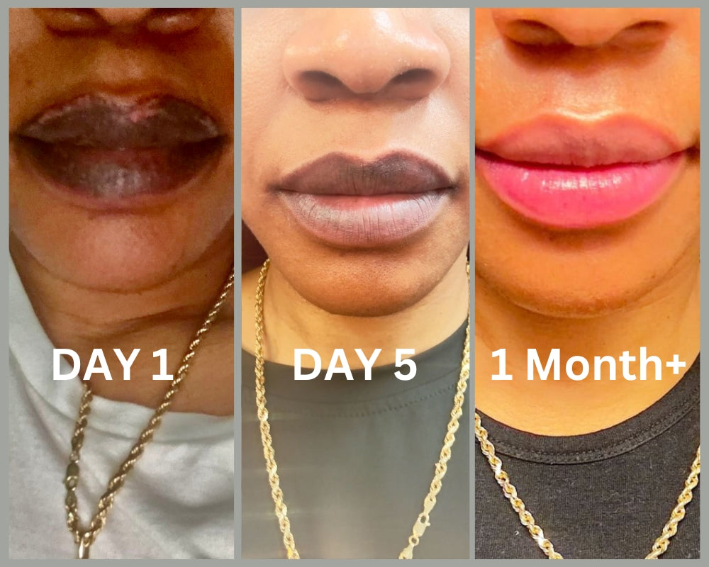 Lips Lightening Cream For Men and Women (Results in 5 Days or Less)