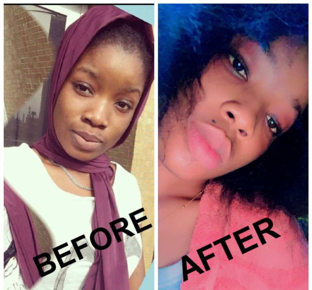 Lips Lightening Cream For Men and Women (Results in 5 Days or Less)