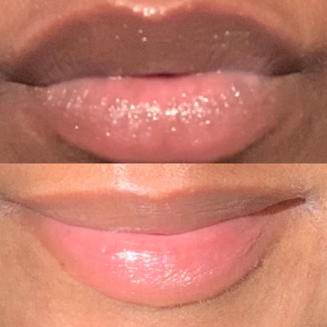Lips Lightening Cream For Men and Women (Results in 5 Days or Less)