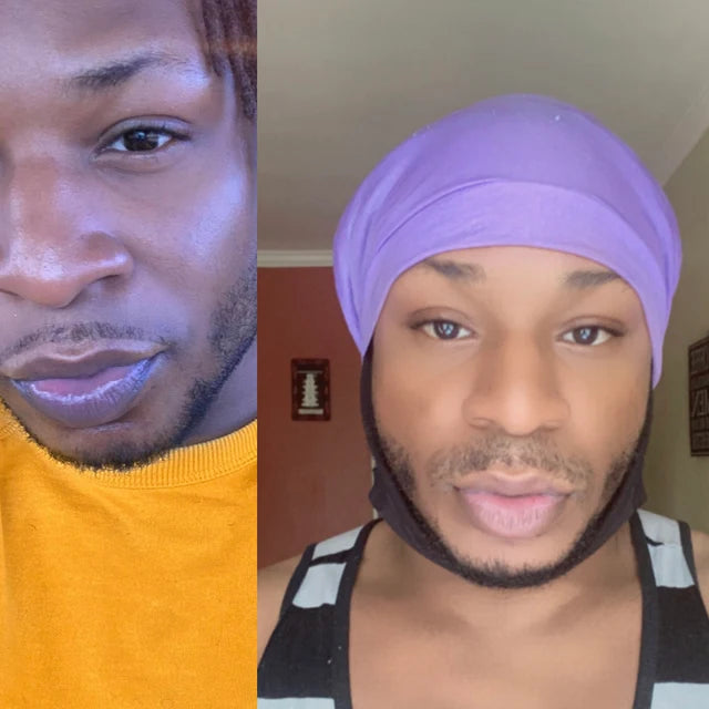 Lips Lightening Cream For Men and Women (Results in 5 Days or Less)