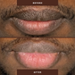 Lips Lightening Cream For Men and Women (5 Days or less transformation)