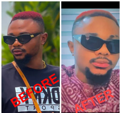 Lips Lightening Cream For Men and Women (Results in 5 Days or Less)