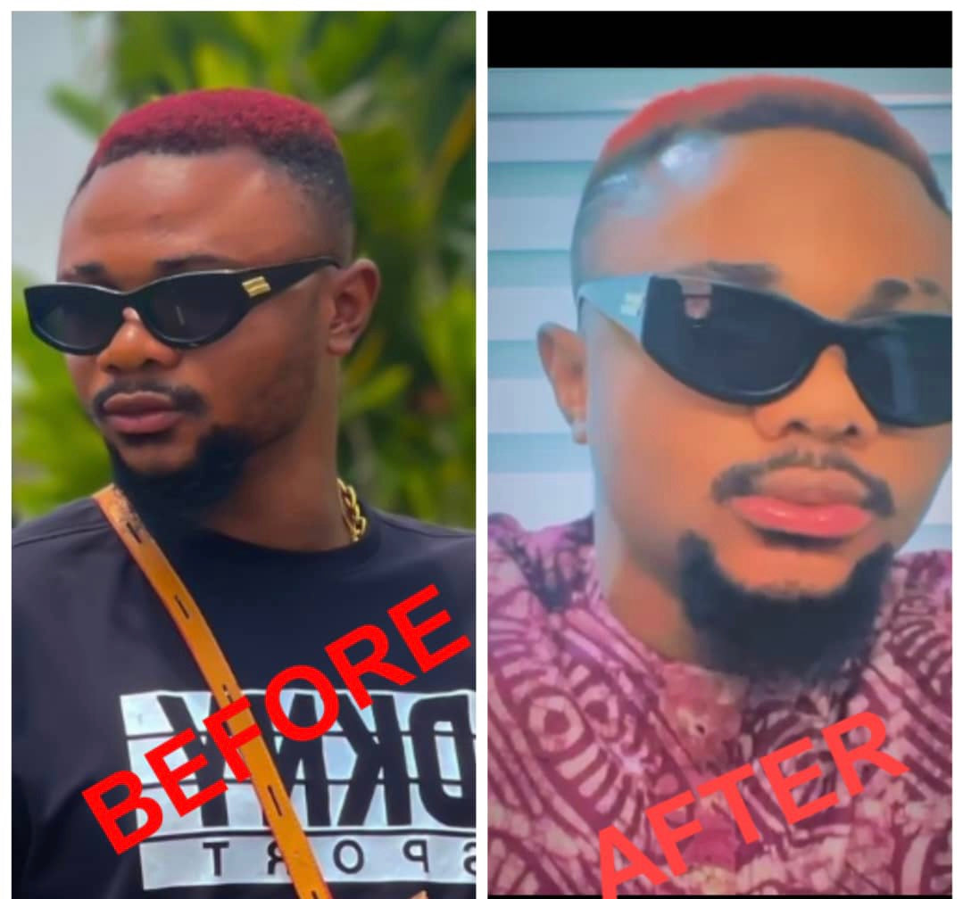 Lips Lightening Cream For Men and Women (Results in 5 Days or Less)