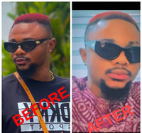 Lips Lightening Cream For Men and Women (Results in 5 Days or Less)