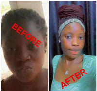 Lips Lightening Cream For Men and Women (Results in 5 Days or Less)