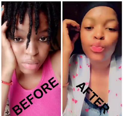 Lips Lightening Cream For Men and Women (Results in 5 Days or Less)