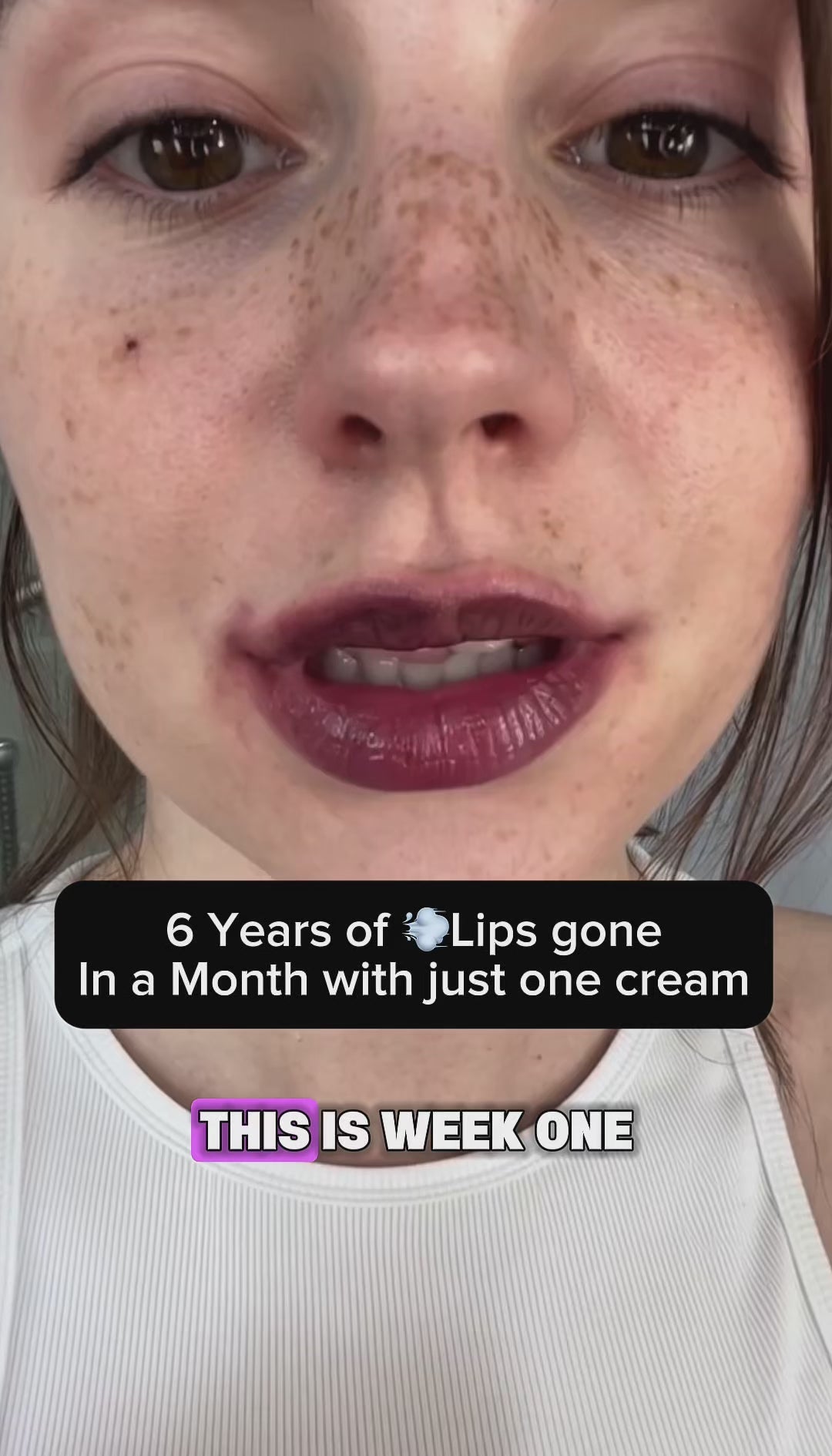 Lips Lightening Cream For Men and Women (Results in 5 Days or Less) video