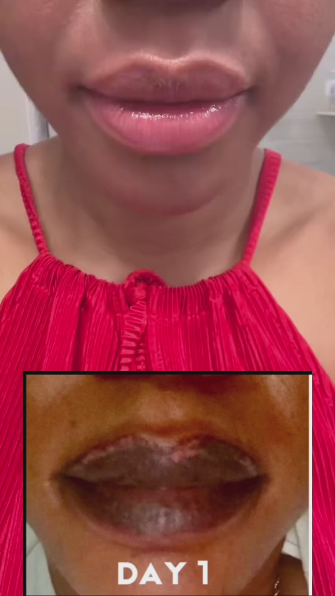 Lips Lightening Cream For Men and Women (Results in 5 Days or Less) video